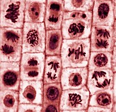 Mitosis, light micrograph