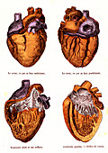 Human heart anatomy, 19th Century illustration