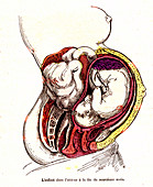 Human foetus in womb, 19th Century illustration