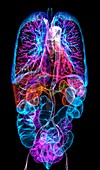 Human internal organs, 3D CT scan