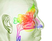 Throat and paranasal sinuses, 3D CT scan
