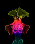 Paranasal sinuses, 3D CT scan