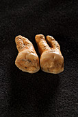 Neanderthal teeth