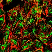 HeLa cervical cancer cells, fluorescence light micrograph