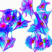 Cells stained for proteins, fluorescence light micrograph