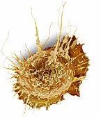 Alveolar macrophage, SEM