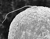 Human egg and sperm, SEM