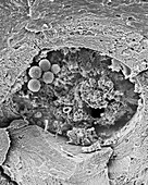 Human stem cells in bone marrow cavity, SEM