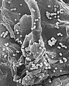 Enterococcus faecium on human skin, SEM
