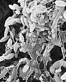 Biofilm on a stainless steel surface, SEM