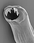 Dog hookworm buccal capsule, SEM