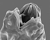 Poultry nematode (Heterakis gallinarum), SEM