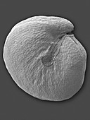 Quinoa seed (Chenopodium quinoa), SEM