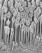 Gecko foot hairs (Hemidactylus frenatus), SEM