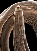 Parasitic roundworm, SEM