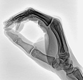 Hand in writing position, X-ray