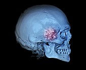 Human skull and site of pituitary gland, 3D CT scan