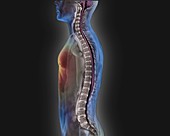 Backbone and spinal cord, MRI scan