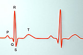 ECG, illustration