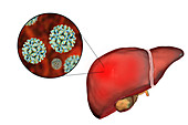 Hepatitis B, illustration