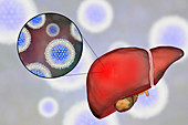 Hepatitis C, illustration