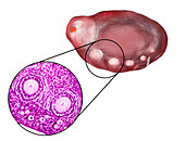 Ovarian follicles, micrograph and illustration