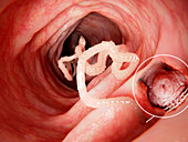 Tapeworm in human intestine, illustration