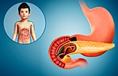 Child's duodenum and pancreas, illustration