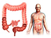 Male large intestine anatomy, illustration