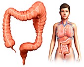 Woman with mega colon, illustration