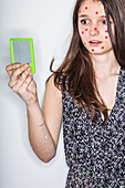 Humorous image of a teenage girl with pimples on the face