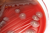 Escherichia coli bacterial culture