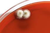 Mould fungus culture on blood agar