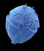 Peridinium dinoflagellate, SEM