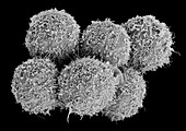 Bladder cancer cells, SEM