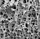 Bone tissue, SEM