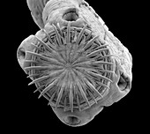 Pork tapeworm, SEM