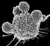 T lymphocytes and cancer cell, SEM