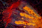 Beetroot (Beta vulgaris) tissue, light micrograph