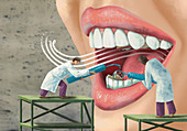 Illustration of dentists examining patient's mouth