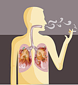 Illustration of human representation smoking cigarette