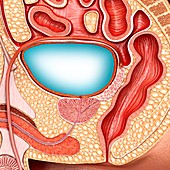 Full male bladder, illustration