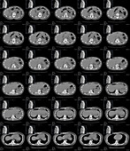 Abdomen and chest anatomy, CT scans