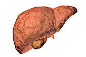 Liver fibrosis, illustration