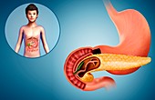 Child's pancreas and duodenum, illustration