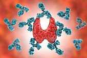 Autoimmune thyroiditis, conceptual illustration