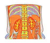 Abdominal organs, CT scan