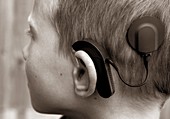 Boy fitted with cochlear implant