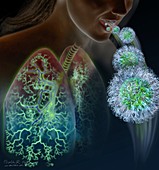 Nanoparticle lung therapy, illustration