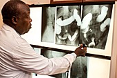 Hospital doctor examining X-rays